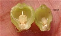  Ovary V.S.